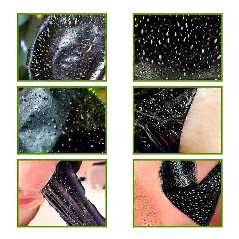 Veraly 100pcs Banda Elimina Puntos Negros Acné Espinillas Limpieza