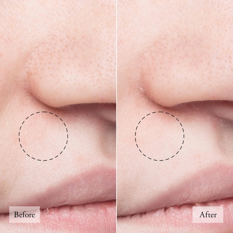 philosophy purity made simple pore extractor mask 1 fl oz