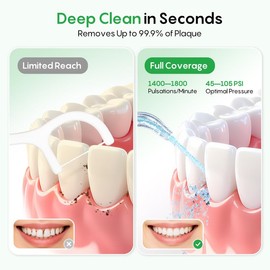 FRESKO Water Dental Flosser for Teeth, 300ML Cordless Flosser with Constant Pressure, Rechargeable Oral Irrigator Cleaner for Travel Home Use and Braces Care, IPX7 Waterproof, 5 Jet Tips