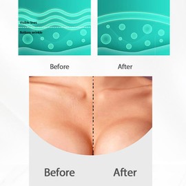 RoseFlower 6er Set Anti-Falten-Patches für Stirn/Kinn/Augenkontur, Transparente Silikon-Patches zur Faltenreduzierung im Schlaf