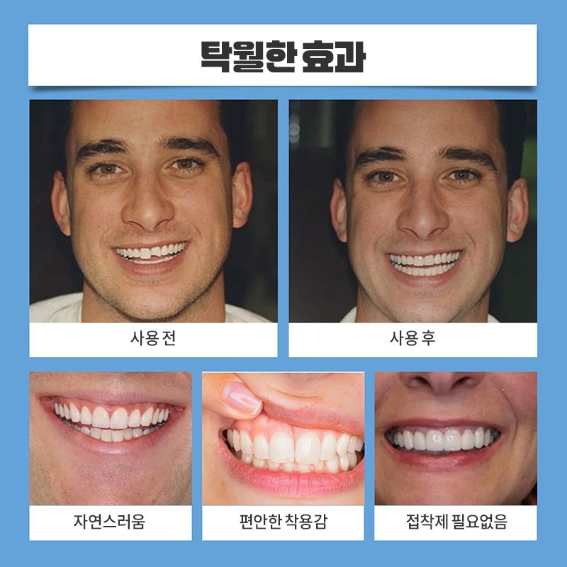 자연스럽고 편안하다 조절 가능한 위아래 치아 교정기 가지런한 자신감 미소