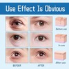 HYAKUON Youthrestore Eye Bag Remover and Firming Cream, Anti-Wrinkle Eye