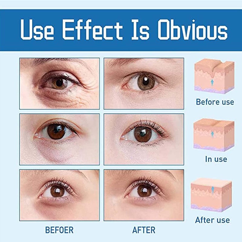 HYAKUON Youthrestore Eye Bag Remover and Firming Cream, Anti-Wrinkle Eye