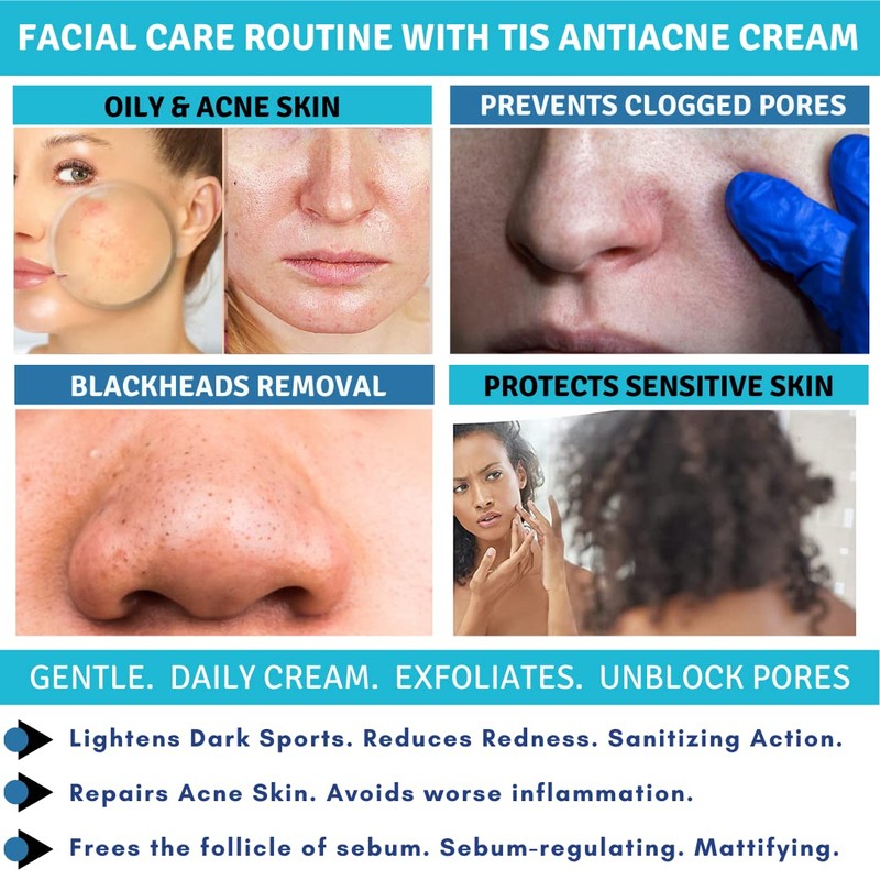 TIS Anti Acne / Pimple Cream 50g