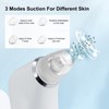 KD802 Blackhead Remover Pore Vacuum Pimple Extractor Acne Removal Kit