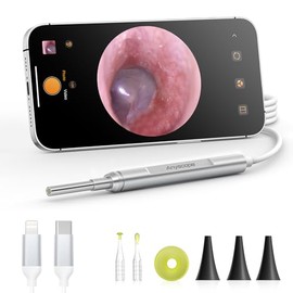 Digital Otoscope Compatible with iPhone and Android Devices, AnyScope HD Ear Camera with Ear Wax Removal Tools, Video Ear Scope Otoscope with Light, Capture Photos and Videos (Silver)