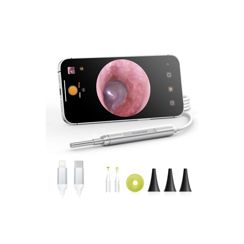 Digital Otoscope Compatible with iPhone and Android Devices, AnyScope HD