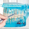 LVCHEN - Modelo de dientes de implante dental transparente, modelo