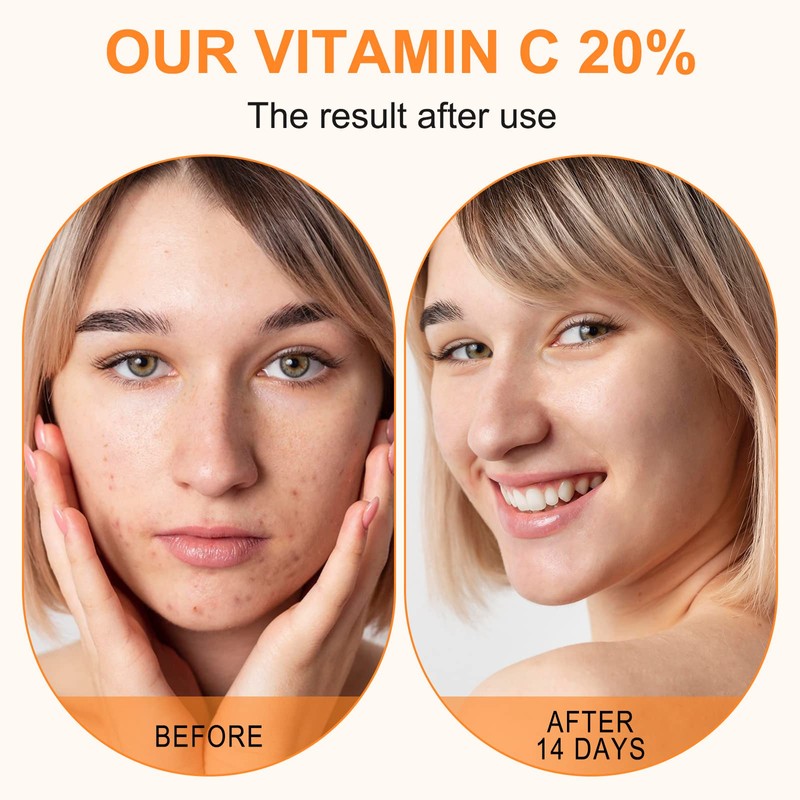 Premium 20% Vitamin C Serum For Face with Hyaluronic Acid,
