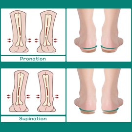 6 pares de plantillas de silicona para talón y cuña mediales y laterales de silicona, plantillas de alineación de pies, plantillas adhesivas para alineación de pies, patas de proa, pierna tipo O/ X