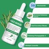 LAKIBOLE 3 Pack Niacinamide Serum with Rosemary Verbena Extract for