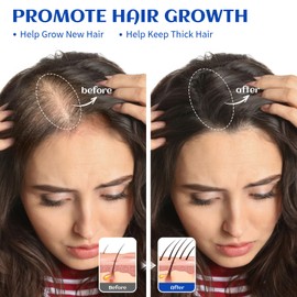 HIQILI 1000ML Rosemary Oil for Hair Growth, Add to Shampoo & Conditioner, 100% Pure Undiluted - 32 Fl Oz