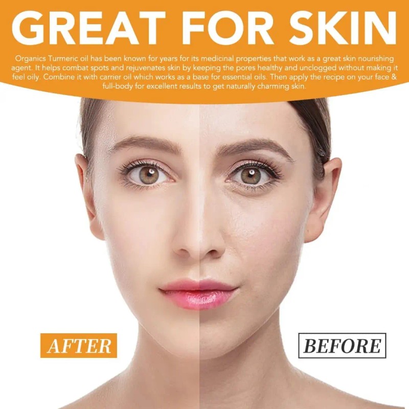 Suero Cúrcuma Facial Corporal Antiedad Manchas Hidratación