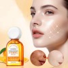 Sérum De Vitamina C: Cuidado Facial Hidratante: Ilumina La P