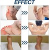 La Crema Puede Aliviar Los Nervios De Los Pies E
