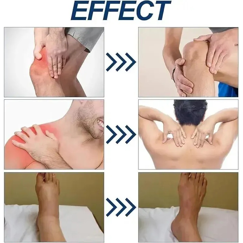 La Crema Puede Aliviar Los Nervios De Los Pies E