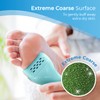 4 x EXTREME Coarse Green Replacement Rollers Compatible with Emjoi