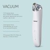 Howlite Vacuum, Limpiador facial contra puntos negros e imperfecciones