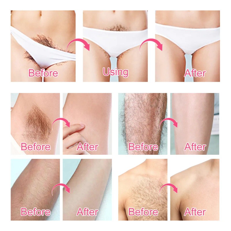 Crema Depilar Mujer Indolora Fórmula Sensible Areas Intimas