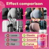 Atherionyxora Gomitas Bbl Para Glúteos Y Caderas 120ct