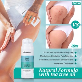 SIRUIMAO Butt Acne Clearing Treatment (3.5OZ), Bum Acne Treatment for Clearing Acne, Pimples, Blackheads, Zits and Razor Bumps for the Buttocks and Thigh Area (1 bottle)