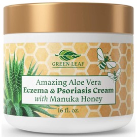 Manuka Honey Eczema Cream Moisturizing Lotion For Psoriasis Relief - Itchy, Dry Skin Rash Ointment -Skin Soothing Moisturizer Baby Kids & Adults-High Strength Body & Face Cream 16oz