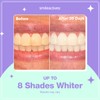 Smileactives Prolite Professional Teeth Whitening Kit, Dental Quality LED Light