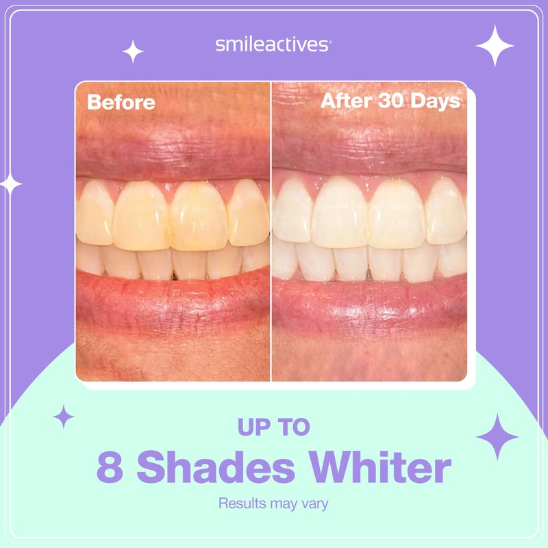 Smileactives Prolite Professional Teeth Whitening Kit, Dental Quality LED Light