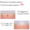 Vacuum Blackhead Suction Acne Removal Electric Pore Cleaner Skin Care