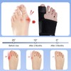 Landrain 1 Pair Hallux Valgus Correction, Hallux Valgus Splint, 2