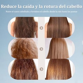 Trichology Shampoo,Champú Anticaída, Champú para el Tratamiento Capilar, Anticaída Promueve el Crecimiento Cabello, Oil Control & Scalp Nourishment, Strengthens Roots para Todo Tipo de Cabello