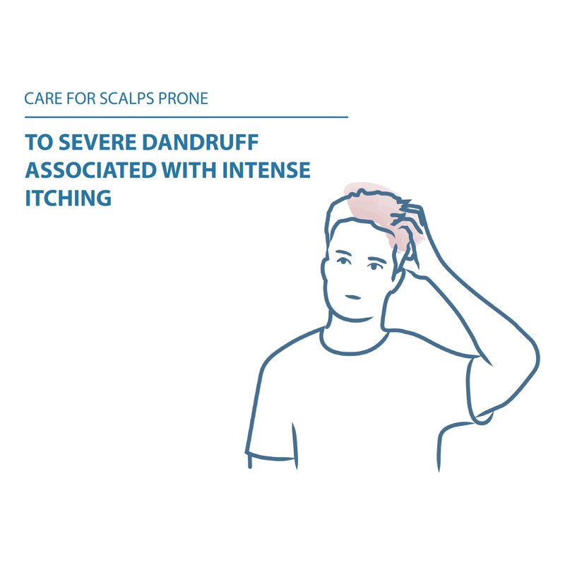 Pierre Fabre Ducray Kelual DS Anti-Reappearance Dandruff Treatment Shampoo, 100