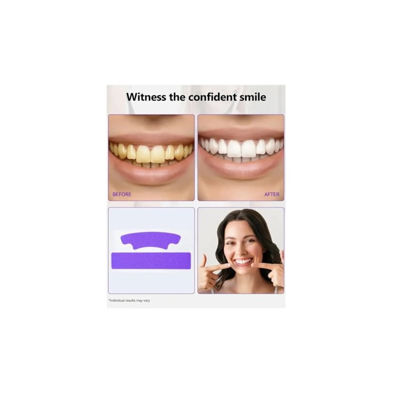 Tiras Blanqueadoras de Dientes Purple Whitening Strips 14 Sesiones |