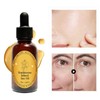 Frankincense Resin Oil for Face, Frankincense Oil for Skin, Frankincense