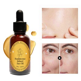 Frankincense Resin Oil for Face, Frankincense Oil for Skin, Frankincense Resin Infused Organic Black Seed, Castor & Jojoba Oil for Face, Facial Moisturizing Anti-Aging Serum (1PC, 1)