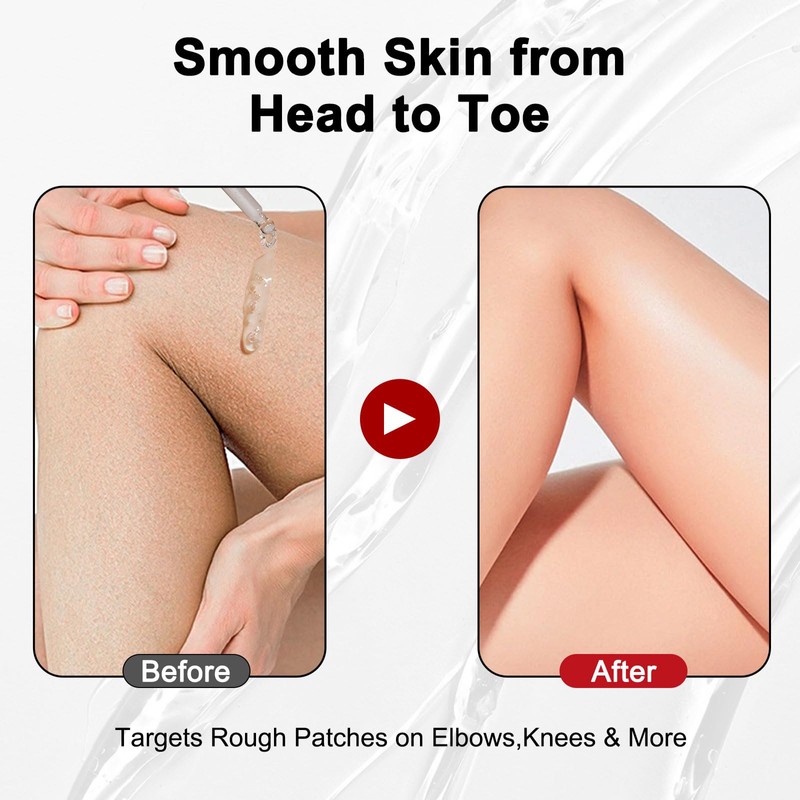 Gentle Exfoliating Serum with Hypochlorous Acid & Rice Extract -