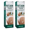 KOAHDE Akne-Creme im Gesäß, Akne-Creme im Gesäß, Gluteus-Hautreparaturcreme, Hüftaknecreme, Creme