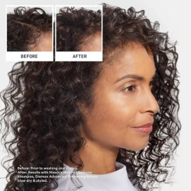 Nioxin Pro Clinical Shampoo Anti Hair Loss 475ml Anticaida                                                                                            