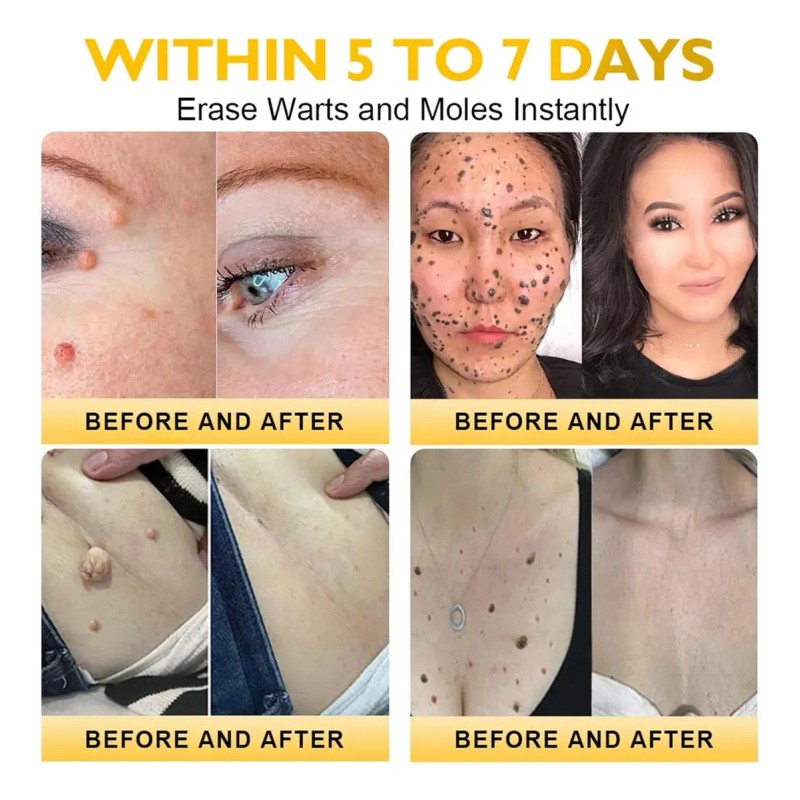 Crema Restauradora De La Piel, Crema Para Tratamiento De La