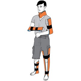 Emergency Splint - 36" Universal Aluminum Rolled Splint, Assorted Colors - Ideal for Sports, Home, First Aid, Pets (Orange, 10 Rolls)