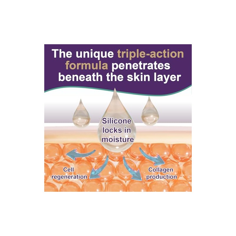 Crema De Silicona Para Cicatrices En Gel: Tratamiento Avanzado Para