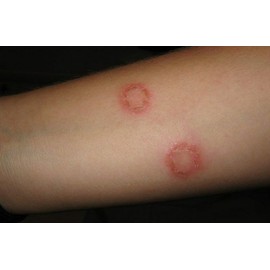 Care All 1 ANTI FUNGAL EXTRA STRENGTH 2% Cream Tube Skin Fungus Ringworm Itching Cosmetic