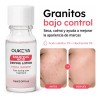 Loción Secante Antiacné Ácido Salicílico 10ml Oukeya