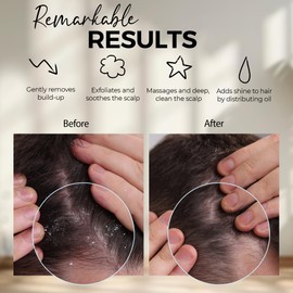 Fiora Naturals Scalp Massager Shampoo Brush - Silicon Scalp Scrubber & Exfoliator for Dandruff Removal and Hair Growth, Scalp Brush for Wet & Dry Hair, Shampoo Brush for Men, Women, Kids - BPA Free