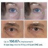 Dr. Melaxin - Eyephalt Crema Para Ojeras 10 ml