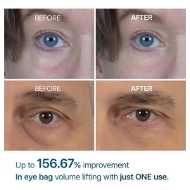 Dr. Melaxin - Eyephalt Crema Para Ojeras 10 ml