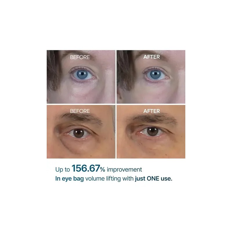 Dr. Melaxin - Eyephalt Crema Para Ojeras 10 ml