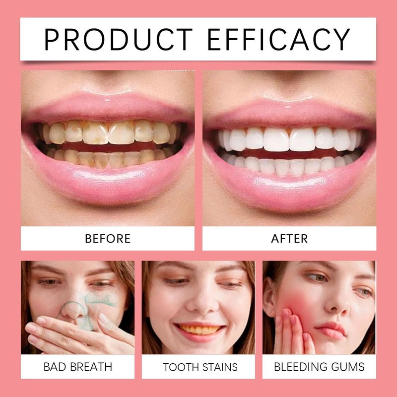 Sp-8 Probiotics Whitening Toothpaste, Sp-8 Probiotic Toothpaste, Sp 8 Probiotic