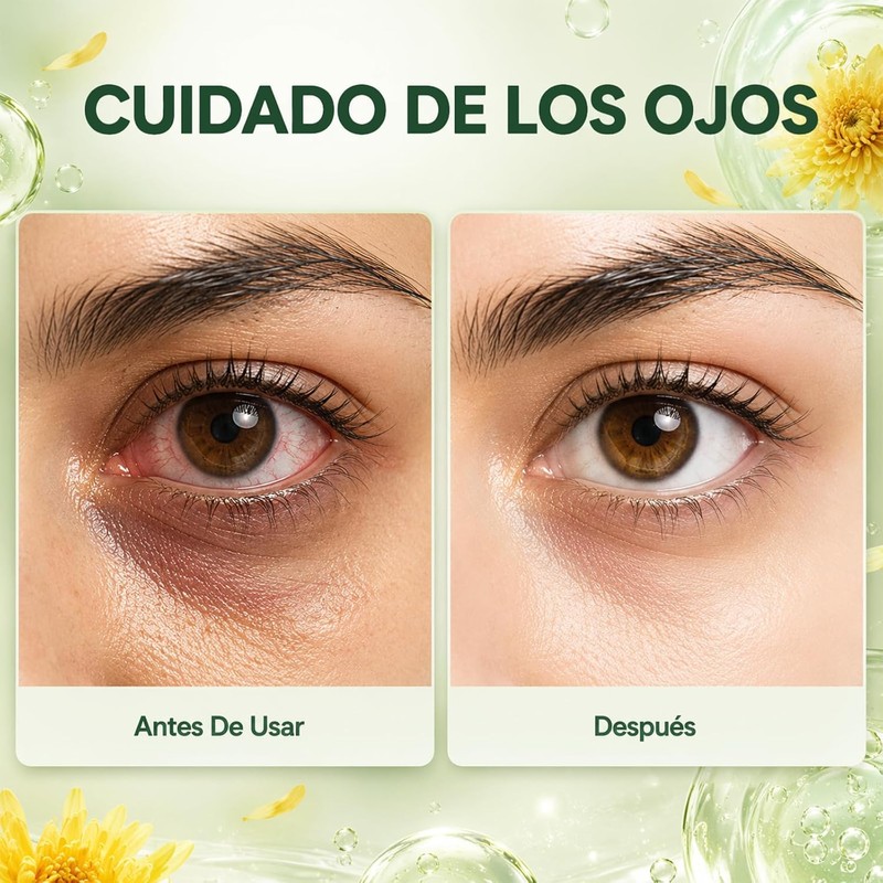 2PCS Spray Ocular de Luteína, Spray Hidratante Suave, 30ML*2