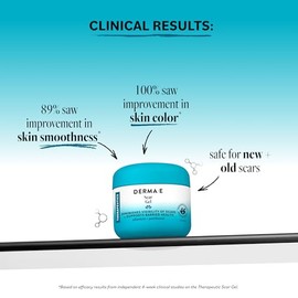 Derma e Scar Gel, 2 oz (56 g)